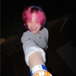 Meet your Posher, Scar